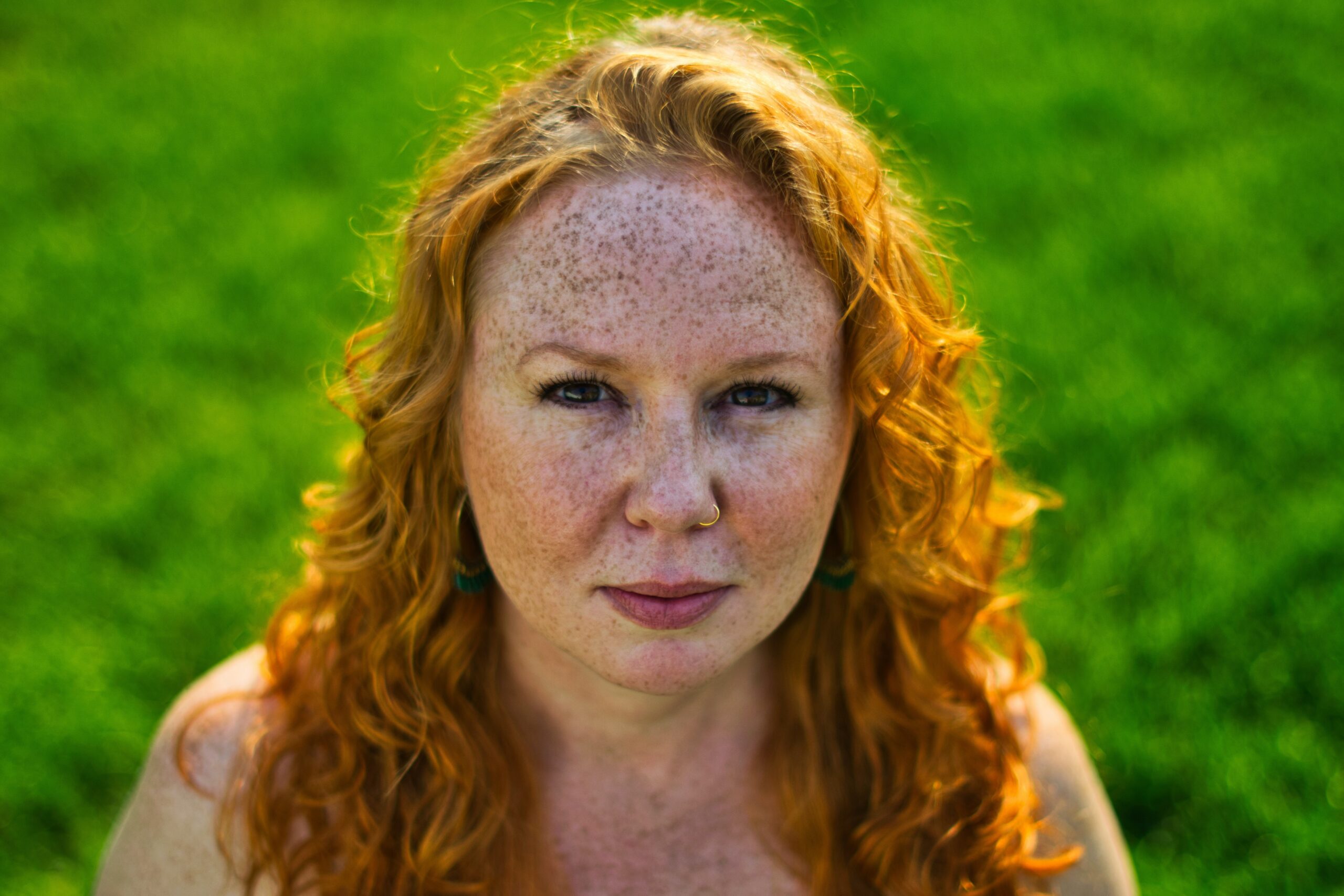 «І на Сонці є плями»: як позбутися ластовиння?