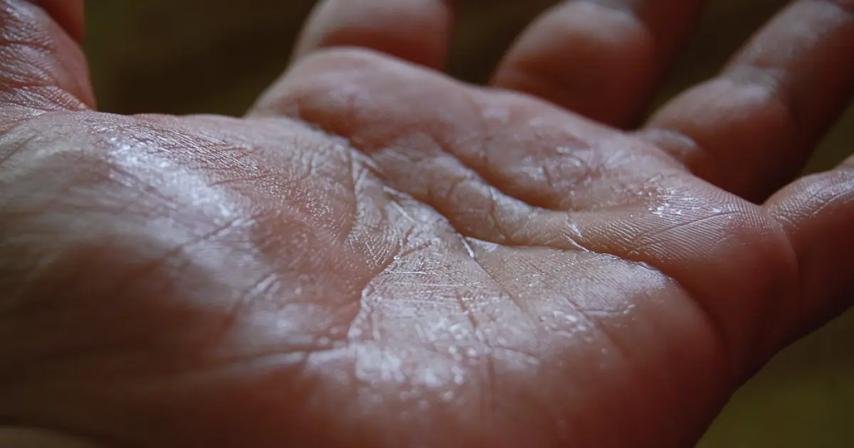 спітніла долоня