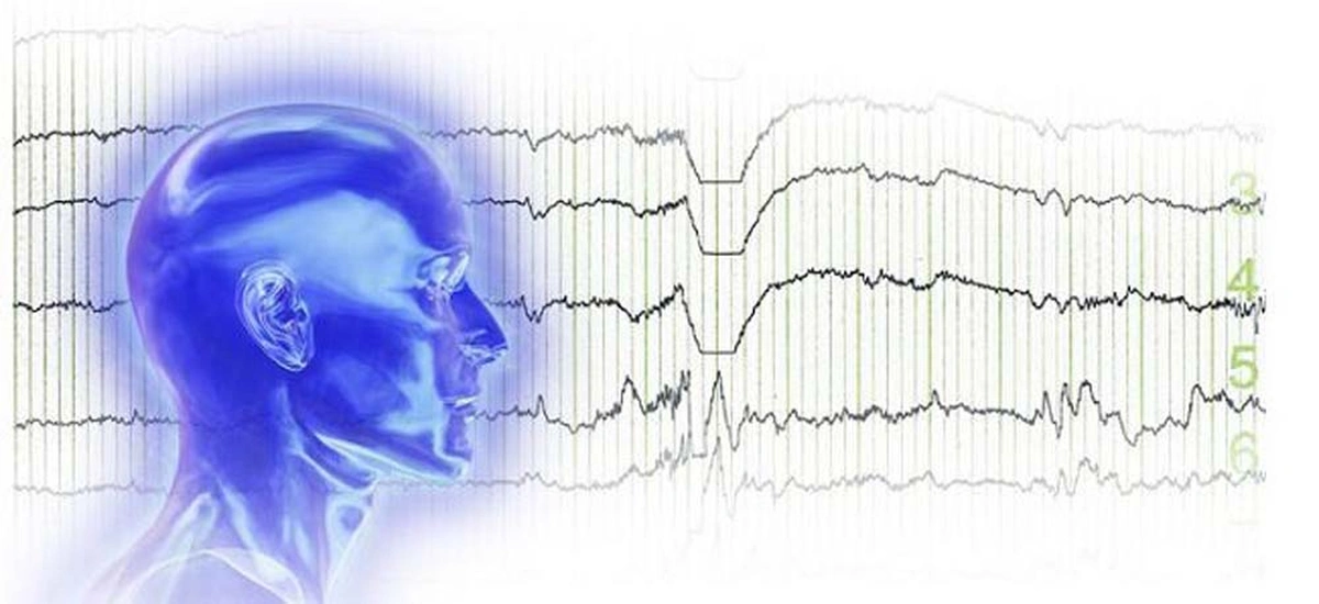 енцефалограма мозку